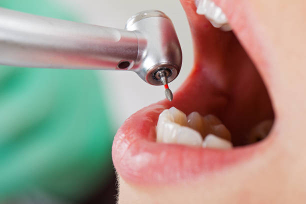 Best Knocked-Out Tooth Emergency  in Mount Carmel, PA